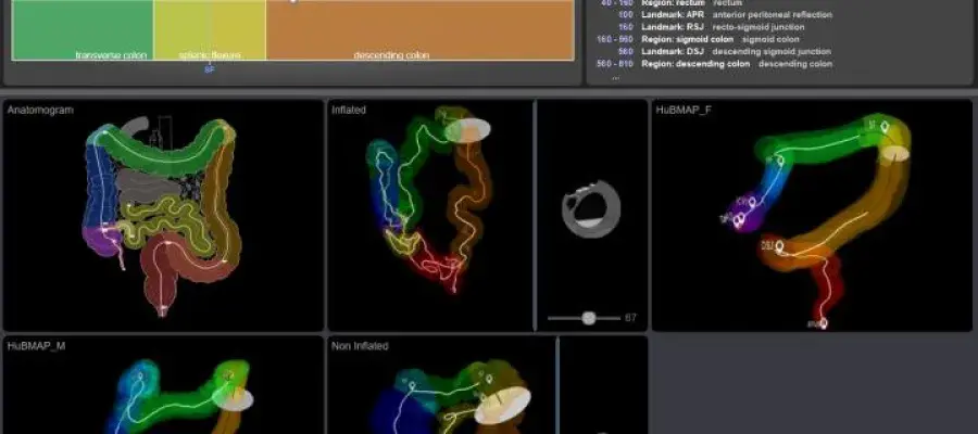 The Helmsley Gut Cell Atlas Project