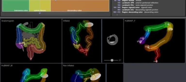 The Helmsley Gut Cell Atlas Project