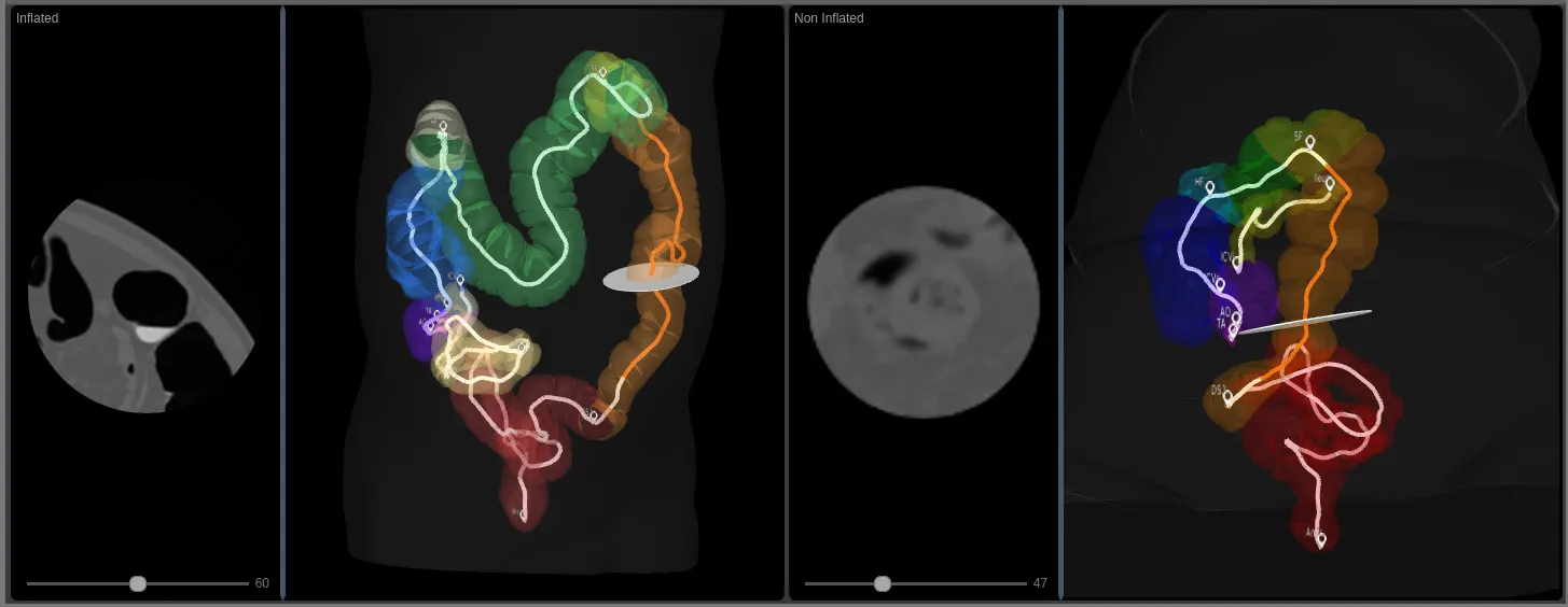 Views through the Helmsley GCA 3D models for the common coordinate framework showing mapping between models