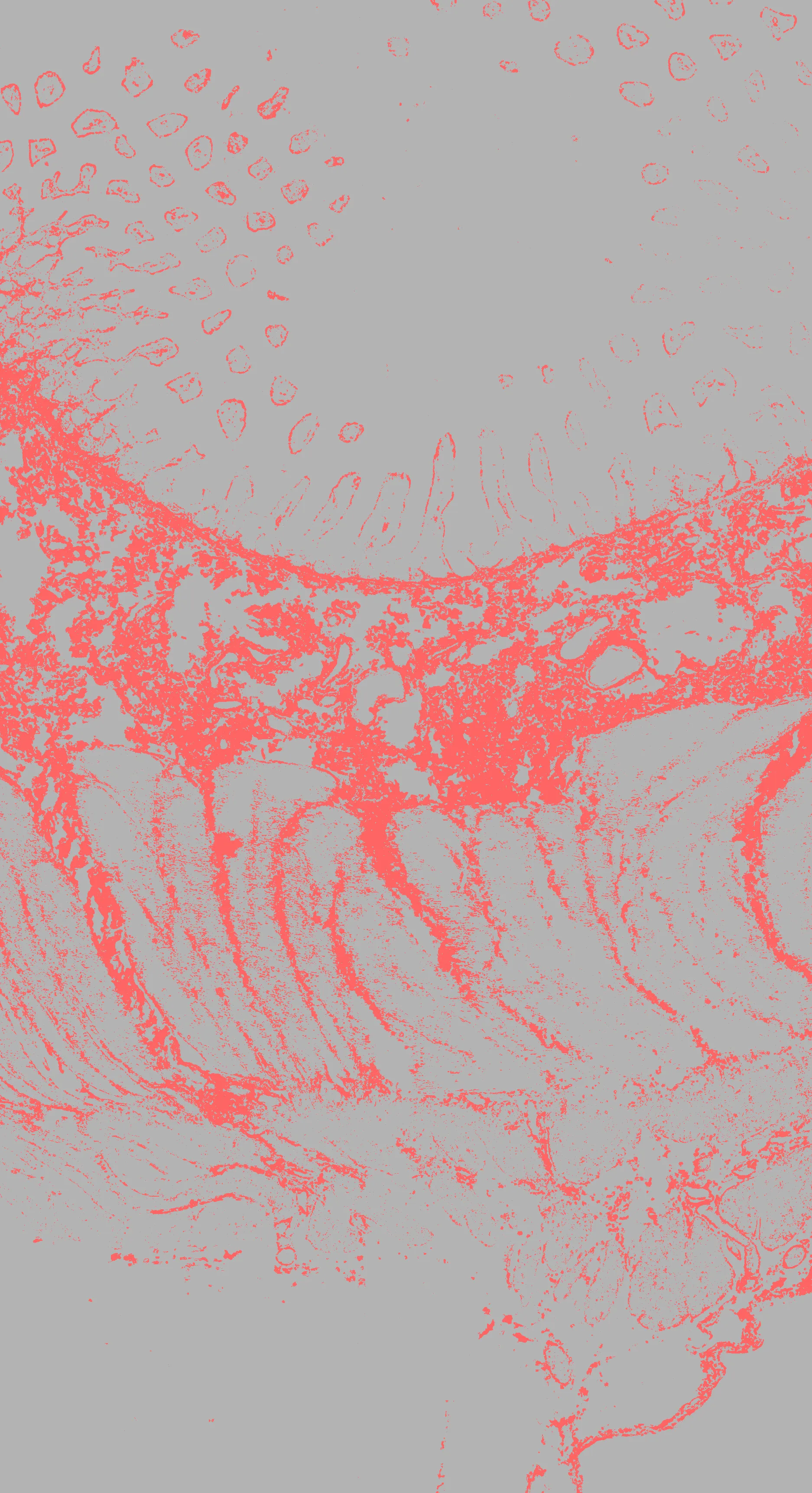 Detection of collagen in the PSR image with QuPath.
