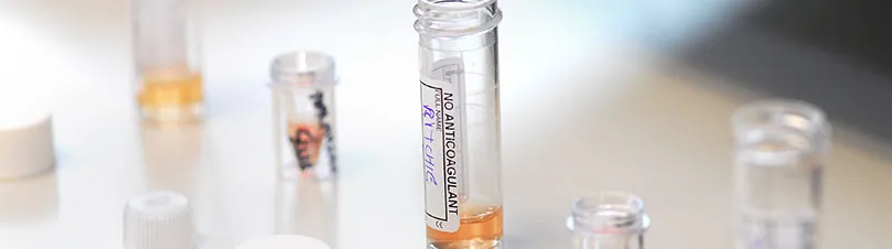 Postgraduate Research