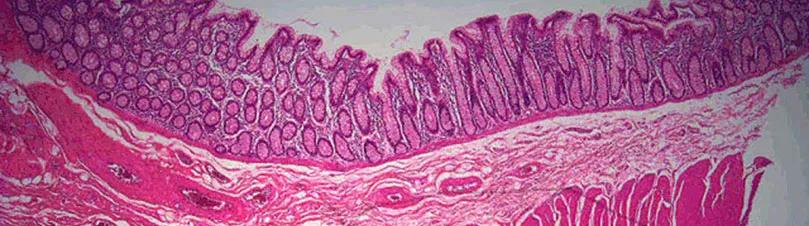 Colon Wall