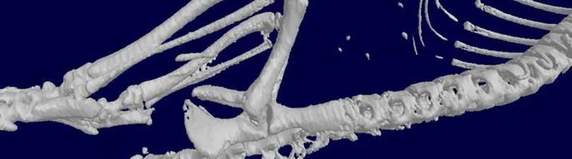 CT Scan